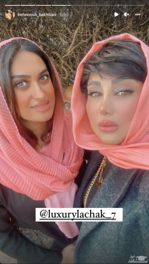 پلنگ ترین عکس از بهنوش بختیاری با تزریق ژل لب پلنگ ترین عکس از بهنوش بختیاری با تزریق ژل لب