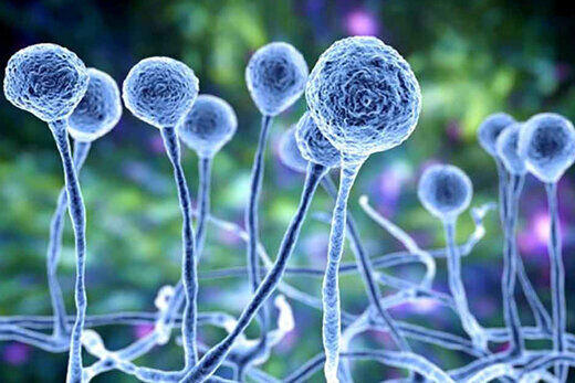 بروز علائم قارچ سیاه چگونه آغاز میشود؟ بروز علائم قارچ سیاه چگونه آغاز میشود؟