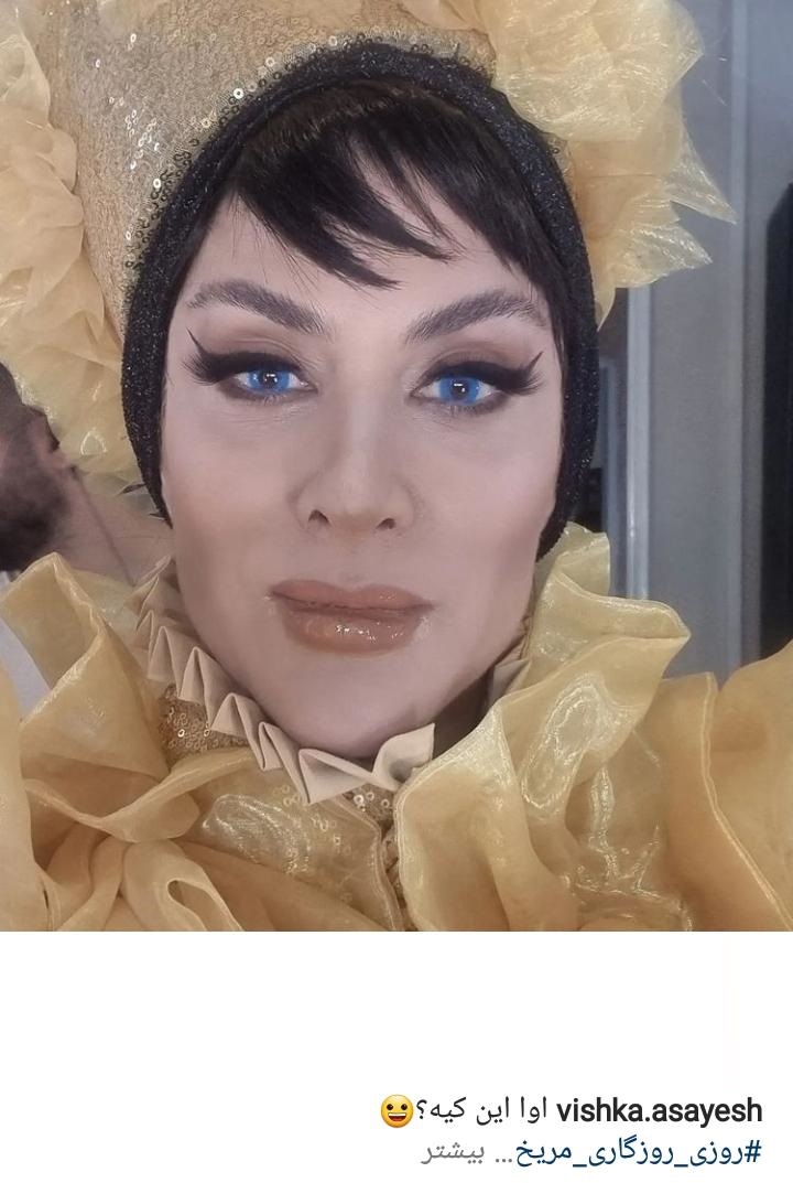 جراحی زیبایی کار درست ویشکا آسایش داد/عکس جراحی زیبایی کار درست ویشکا آسایش داد/عکس