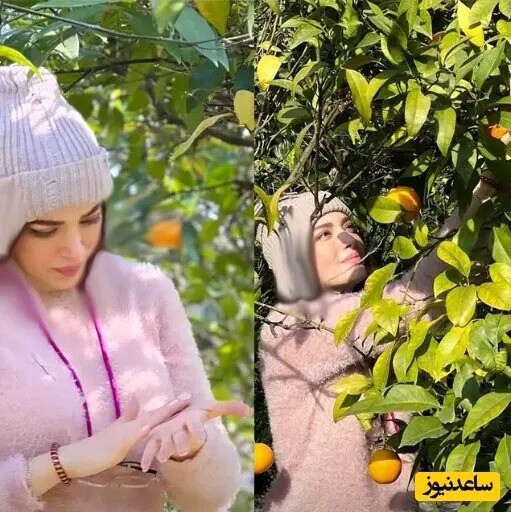 نتیجه عمل زیبایی جدید بهنوش طباطبایی/عکس نتیجه عمل زیبایی جدید بهنوش طباطبایی/عکس