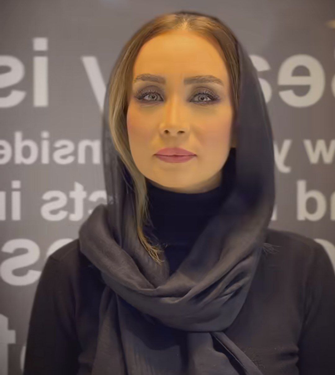 تغییر چهره حدیث فولادوند بعد از جراحی بینی ترمیمی/ عکس