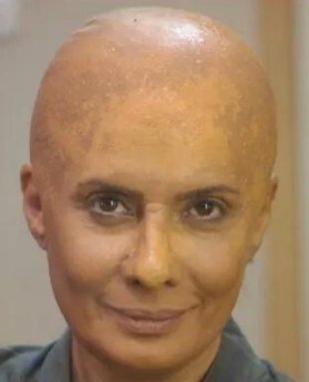 عکسی نارحت کننده از عاطفه رضوی با موهای کچل عکسی نارحت کننده از عاطفه رضوی با موهای کچل