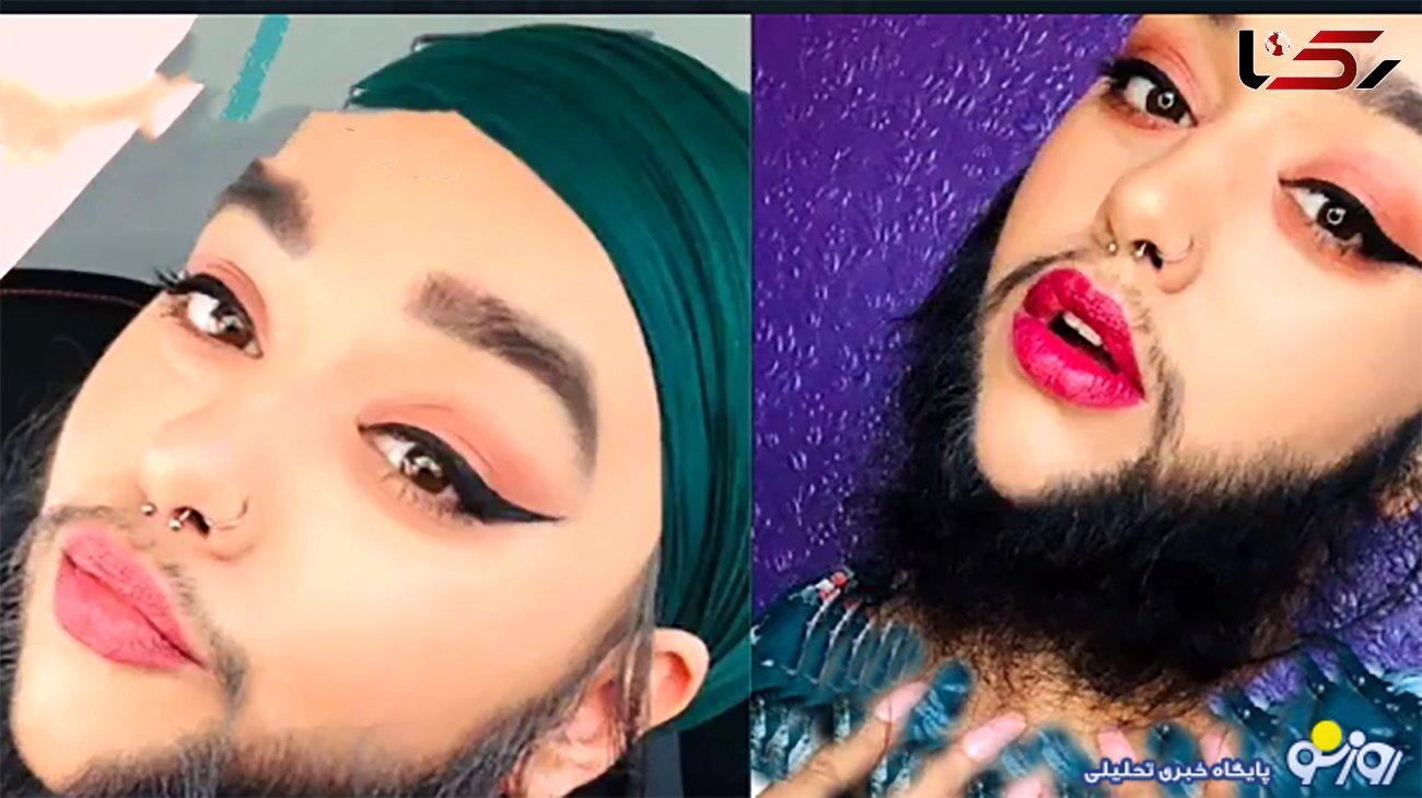 ازدواج دختر ریش دار جهان ! + لباس عروس زیبایش را ببینید
