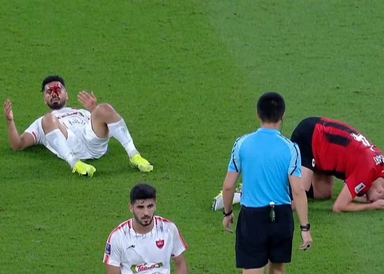 بازیکنان الریان متخصص ریختن خون کاپیتان پرسپولیس!