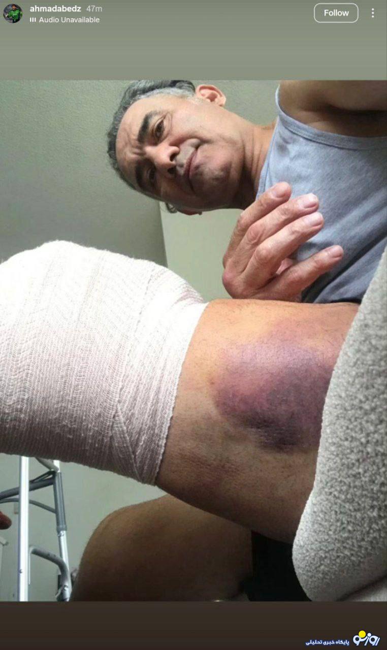 عکس دردناک از عابدزاده در آمریکا/عکی عکس دردناک از عابدزاده در آمریکا/عکی