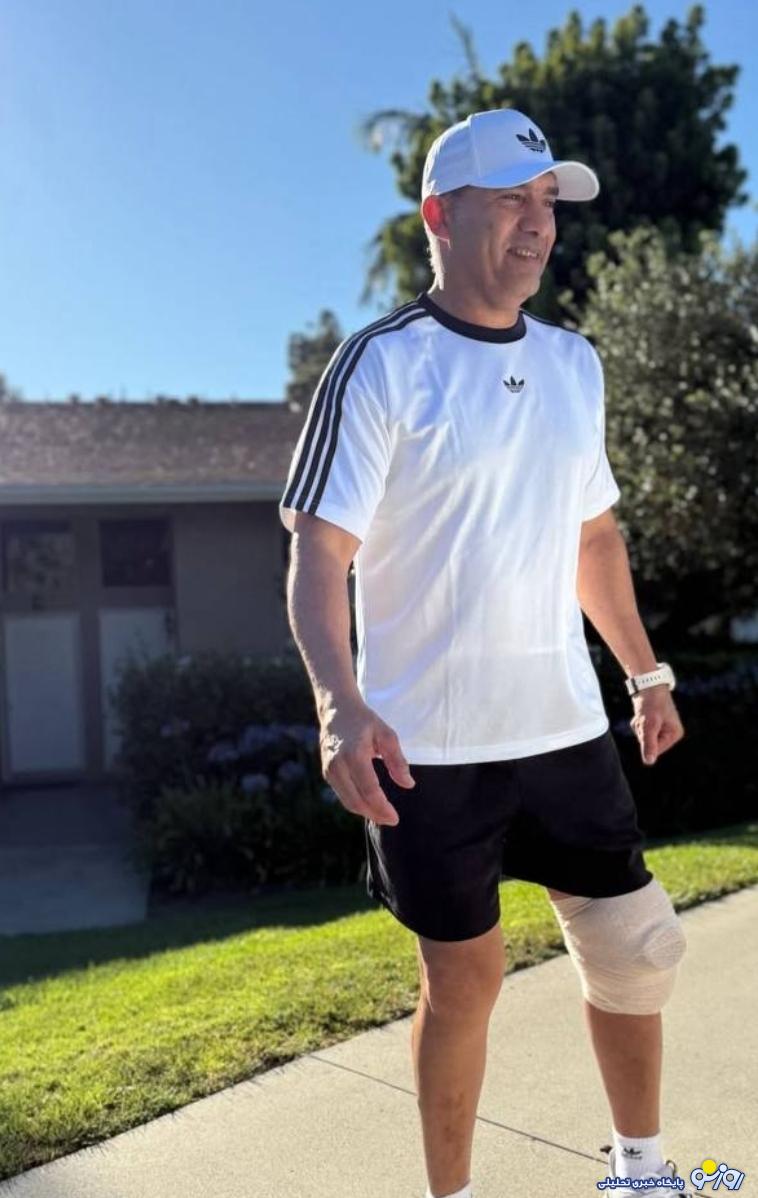 استایل احمدرضا عابدزاده پس از عمل جراحی استایل احمدرضا عابدزاده پس از عمل جراحی