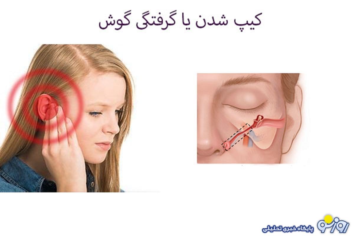 برای گرفتگی گوش چیکار کنیم؟