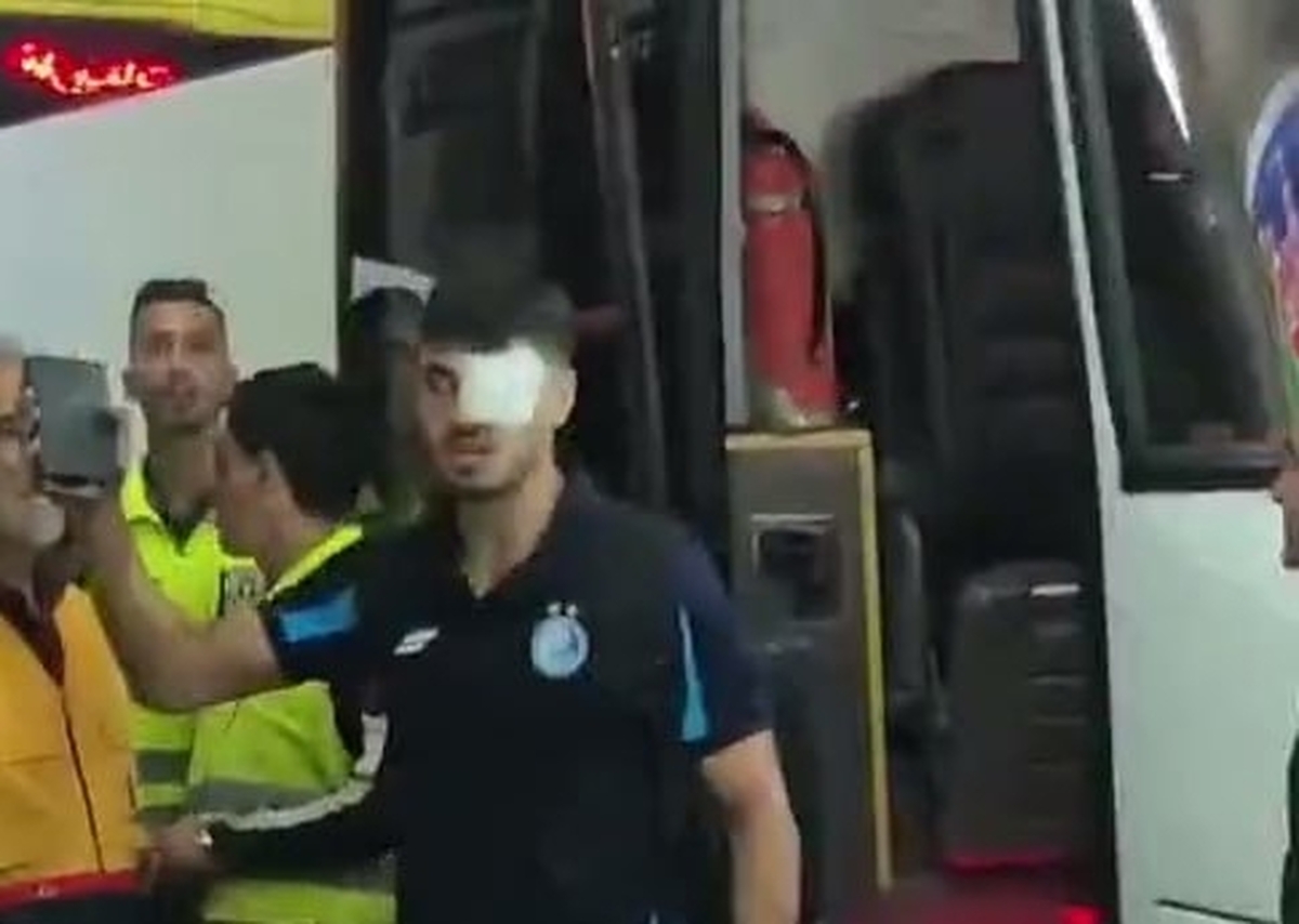 مهاجم استقلال : چشمم نمیبیند(+عکس) مهاجم استقلال : چشمم نمیبیند(+عکس)