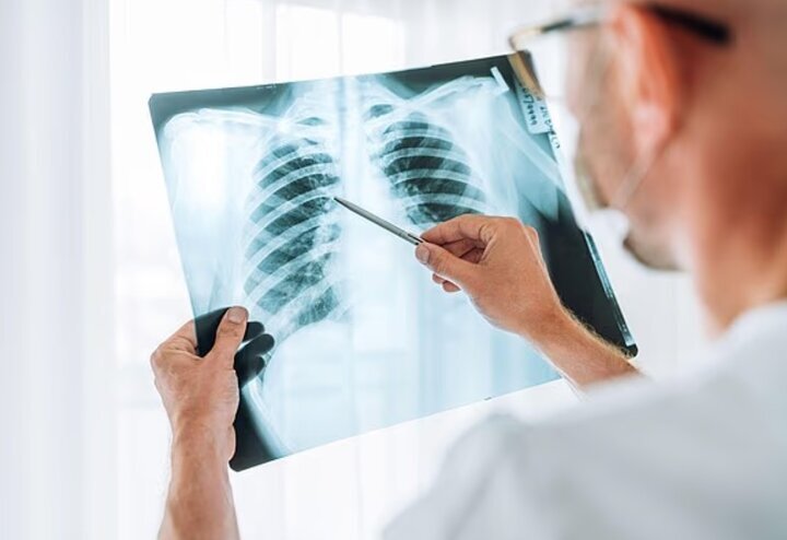 چرا آنفلوآنزا گاهی کشنده میشود؟ چرا آنفلوآنزا گاهی کشنده میشود؟